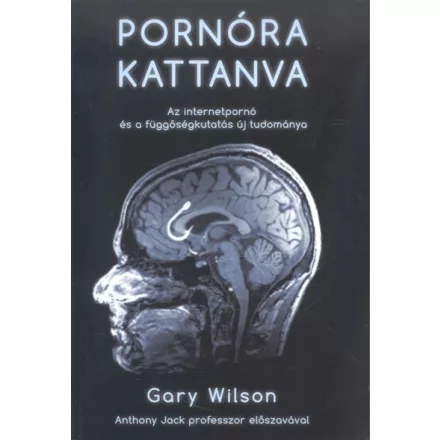 Pornóra kattanva